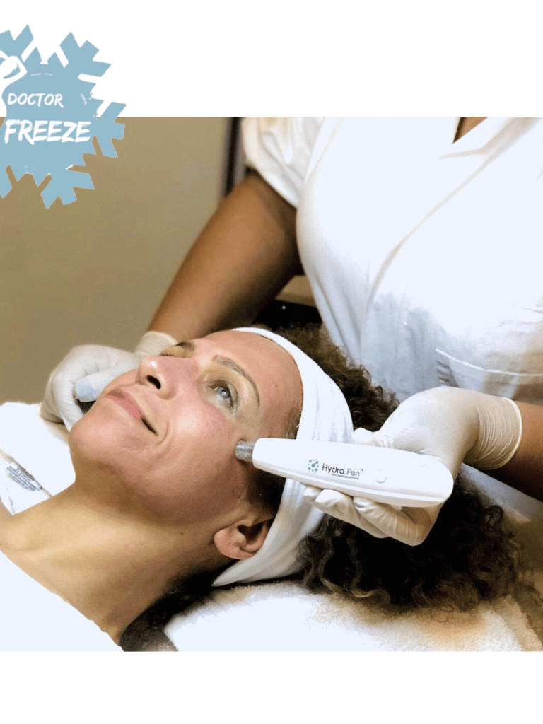Mikroneedling - Anti-Aging Gesichtsbehandlung