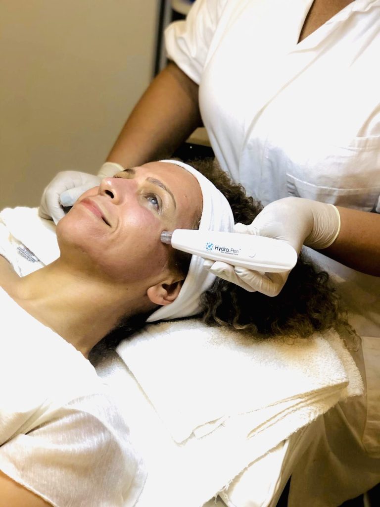 Microneedling Behandlung in Hannover